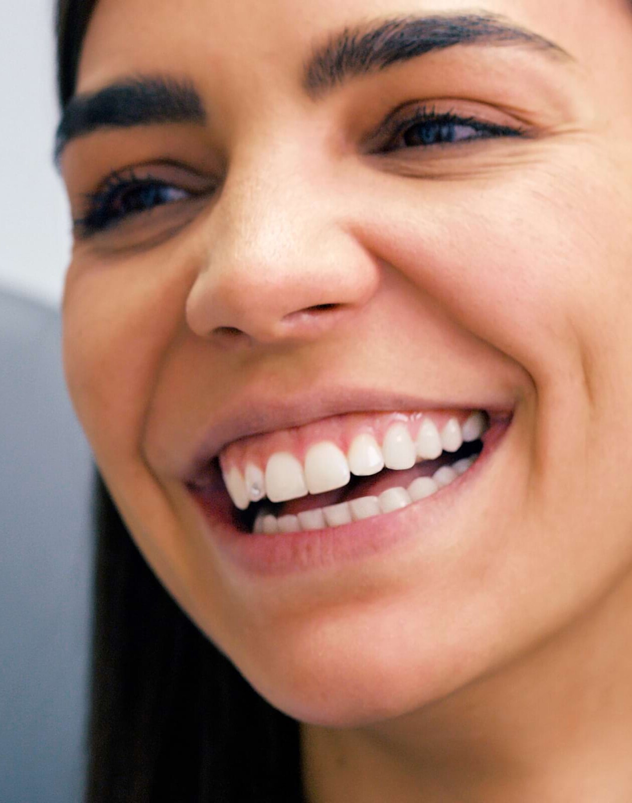 Style your smile: Zahnschonender Glamour mit Skyce-Zahnschmuck