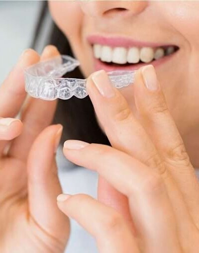 Was kostet die Behandlung mit Invisalign&reg;?