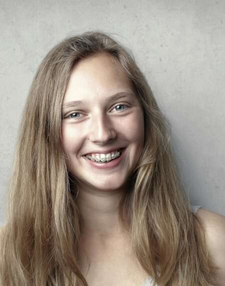 Saubere Z&auml;hne trotz Brackets &ndash; dank diesen Zahnpflegetipps
