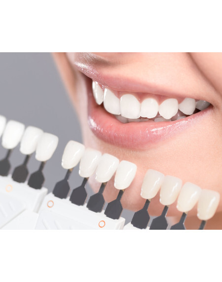 Hollywoodreifes L&auml;cheln dank Veneers aus der Zahnboutique in Z&uuml;rich