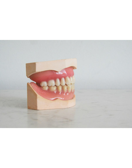 Ihr Zahnarzt aus Zürich erklärt alles zum Thema Zahnfleischschwund