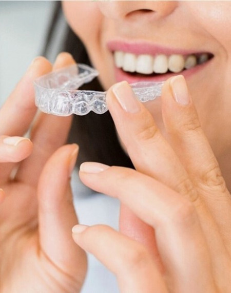 Zahnwanderung &ndash; mit Invisalign kehren Z&auml;hne schonend und nahezu unsichtbar an ihren Platz zur&uuml;ck