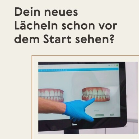 Instagram-Post der Zahnboutique Z&uuml;rich &ndash;&nbsp;3D-Simulation von Zahnbegradigung mittels Aligner-Therapie