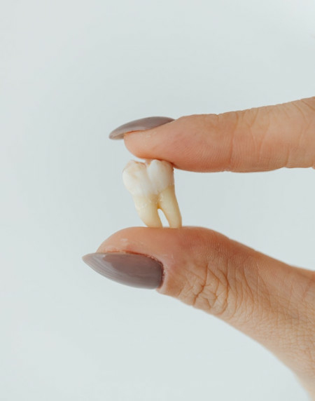 Abgebrochener Zahn – und nun?
